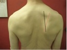scapular areas for corrective shoulder program