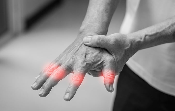 a man with an overuse injury in his hand