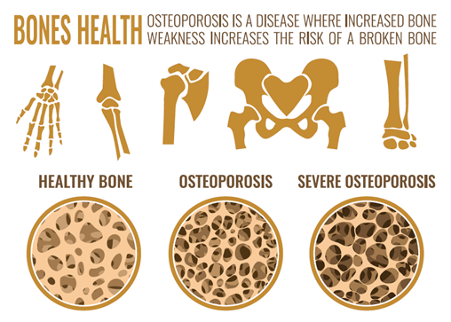 bones health diagram